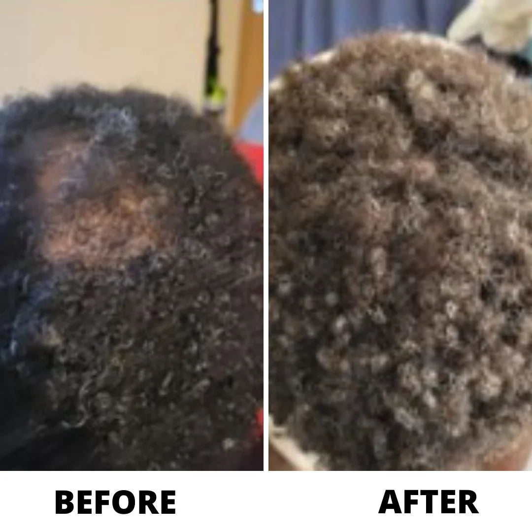 OLIN Hair Density Roll-On