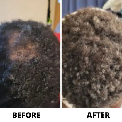 OLIN Hair Density Roll-On