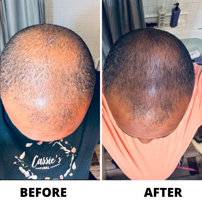 OLIN Hair Density Roll-On