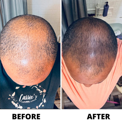 OLIN Hair Density Roll-On