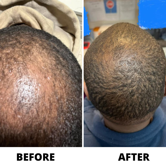 OLIN Hair Density Roll-On