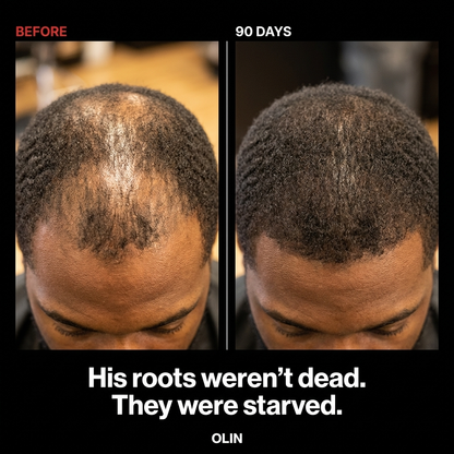 OLIN Hair Density Roll-On